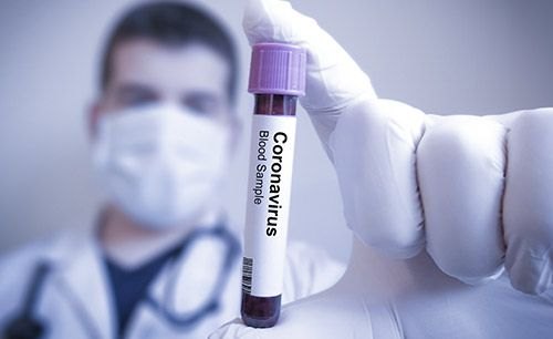 Opportunities in the coronavirus crisis: How companies can prepare for the time after the crisis